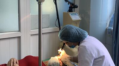 Bác sỹ Phòng khám Da liễu (Bệnh viện Đa kho sử dụng máy Laser CO2 điều trị bệnh da liễu cho người bệnh.