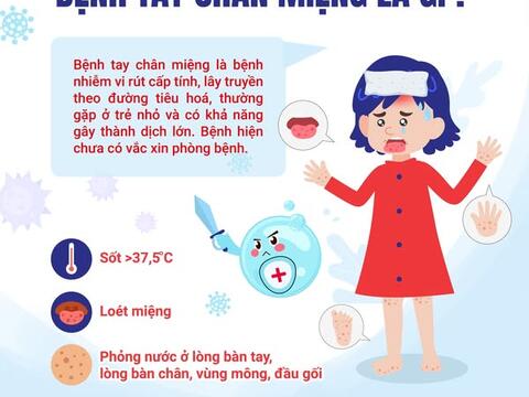 CẢNH GIÁC VỚI BỆNH TAY CHÂN MIỆNG Ở TRẺ EM